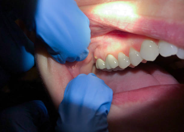 Best Emergency TMJ Treatment in Orem, UT